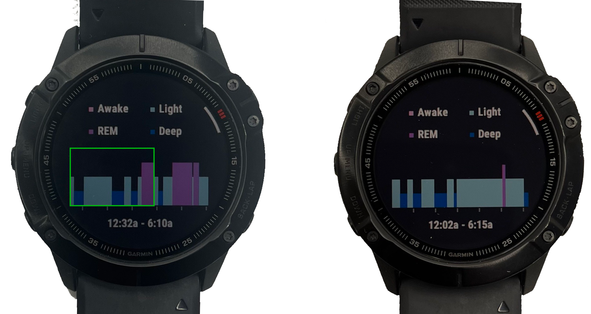 Sleep tracker showing a normal sleeping pattern on the left and a sleeping pattern without REM-phase on the right